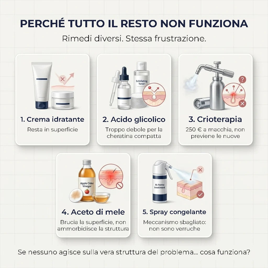 SK Renewal 40 – Crema Levigante all'Urea 40%