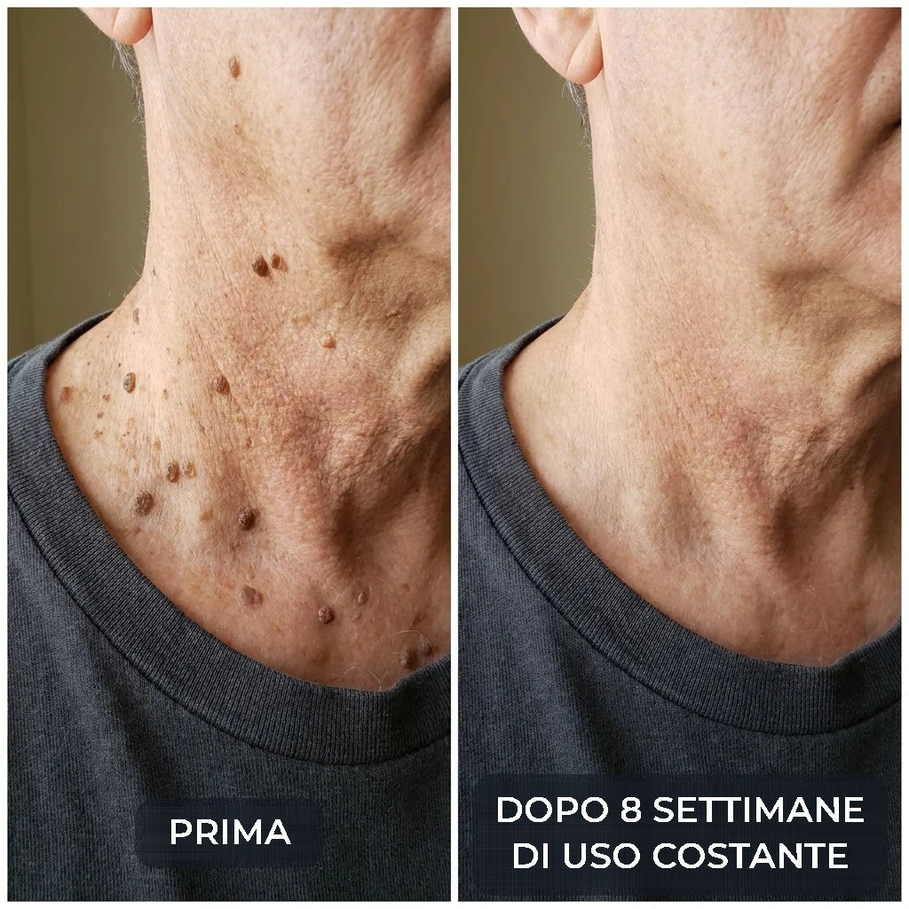 SK Renewal 40 – Crema Levigante all'Urea 40%