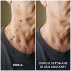SK Renewal 40 – Crema Levigante all'Urea 40%